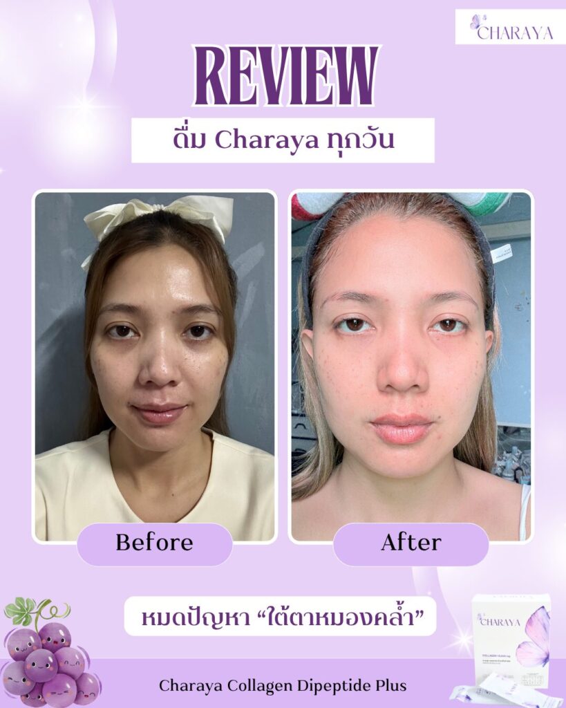 คอลลาเจน,คอลลาเจนผิวใส,collagen,คอลลาเจนลดใต้ตาคล้ำ,charaya