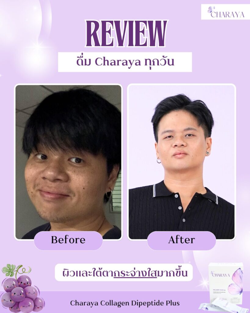 คอลลาเจน,คอลลาเจนผิวใส,collagen,คอลลาเจนลดใต้ตาคล้ำ,charaya